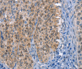 Anti-Human UCK1 Antibody - ABMIUM