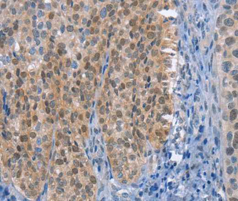Anti-Human UCK1 Antibody