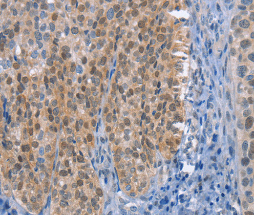 Anti-Human UCK1 Antibody - ABMIUM