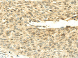 Anti-Human/Mouse SHPRH Antibody - ABMIUM