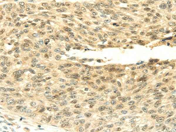 Anti-Human/Mouse SHPRH Antibody