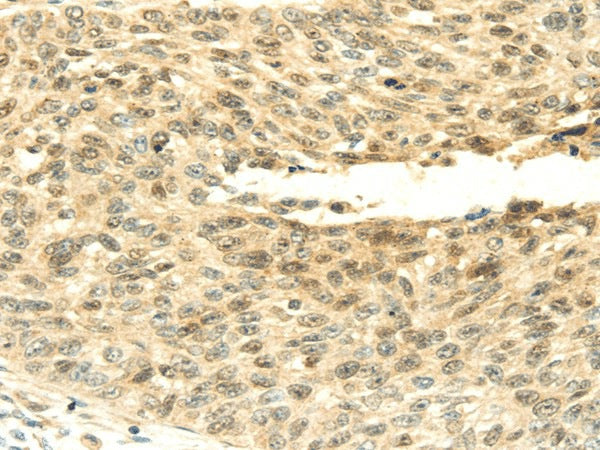 Anti-Human/Mouse SHPRH Antibody - ABMIUM