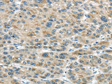 Anti-Human TRAIP Antibody - ABMIUM