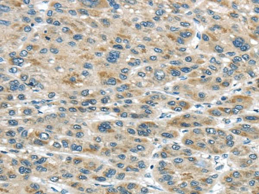 Anti-Human TRAIP Antibody - ABMIUM