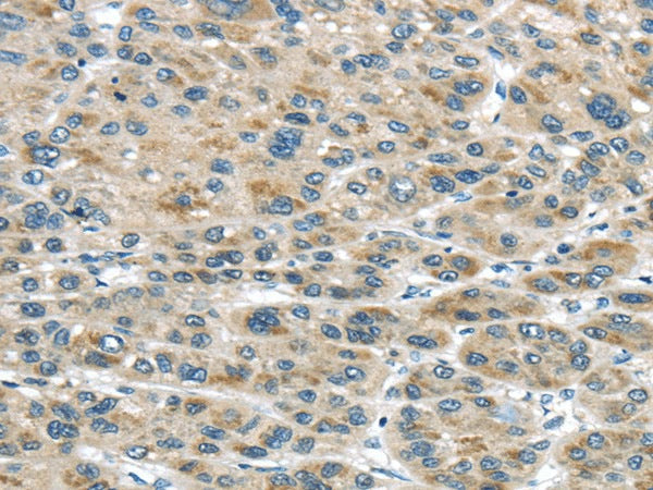 Anti-Human TRAIP Antibody - ABMIUM