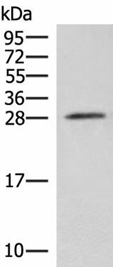Western blot analysis of Mouse brain tissue lysate using NIPSNAP3A Polyclonal Antibody at dilution of 1:550