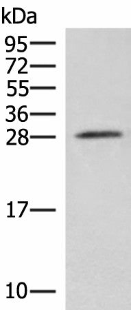 Western blot analysis of Mouse brain tissue lysate using NIPSNAP3A Polyclonal Antibody at dilution of 1:550