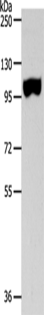 Anti-Human SPAG1 Antibody - ABMIUM