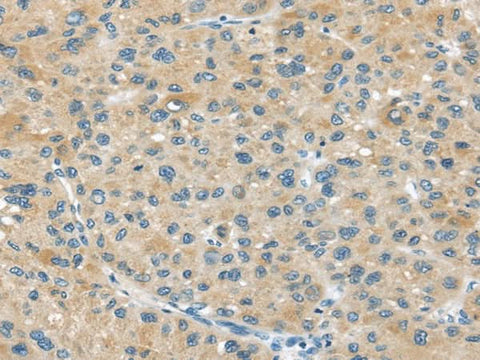 Anti-Human ABCC2 Antibody - ABMIUM
