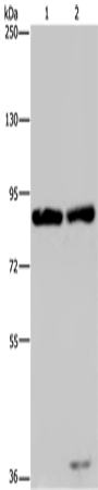 Anti-Human/Mouse/Rat MRE11A Antibody - ABMIUM