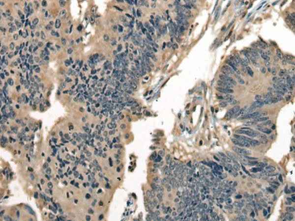 Anti-Human/Mouse/Rat DNAJC2 Antibody