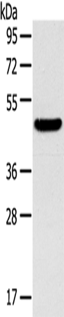 Anti-Human/Mouse TM7SF2 Antibody - ABMIUM