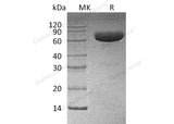 Recombinant Human PD-L1/B7-H1/CD274 Protein (mFc Tag) - ABMIUM