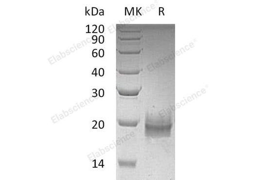 Recombinant Human Trefoil Factor 2/TFF2 Protein (His Tag) - ABMIUM