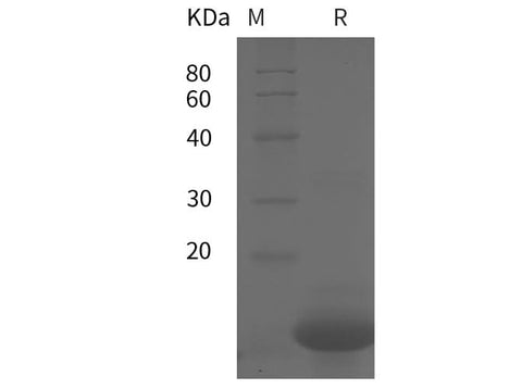 Recombinant Human IL18 Protein (Avi,His Tag) - ABMIUM