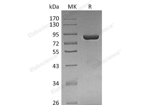 Recombinant Human THOP1 Protein (His Tag) - ABMIUM