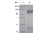 Recombinant Human IGF-I R/IGF1R (C-6His) - ABMIUM