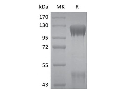 Recombinant Human IGF-I R/IGF1R (C-6His) - ABMIUM