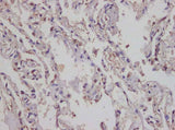 Anti-Human IL-17A Antibody - ABMIUM