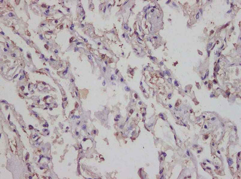 Anti-Human IL-17A Antibody - ABMIUM