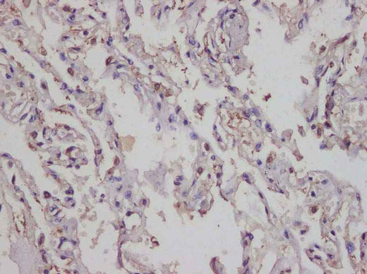 Anti-Human IL-17A Antibody - ABMIUM