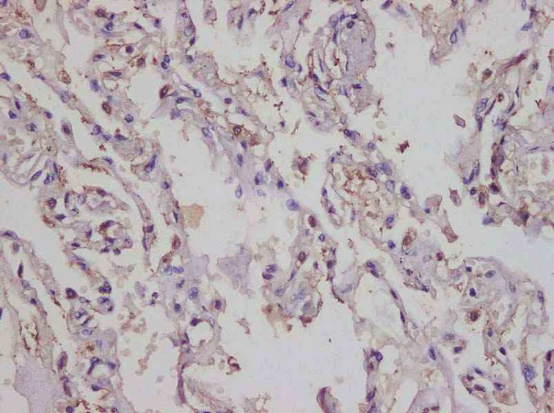 Anti-Human IL-17A Antibody - ABMIUM