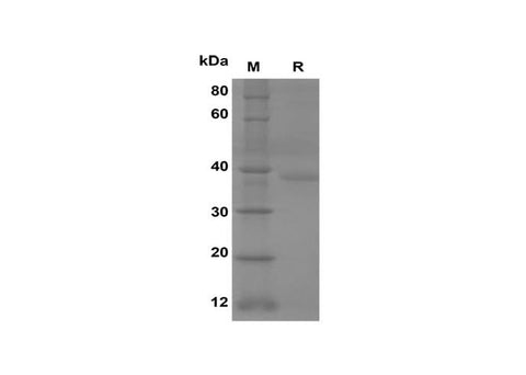 SDS-PAGE analysis of Human SNCα proteins, 2 μg/lane of Recombinant Human SNCα proteins was resolved with SDS-PAGE under reducing conditions, showing bands at 37 kDa.