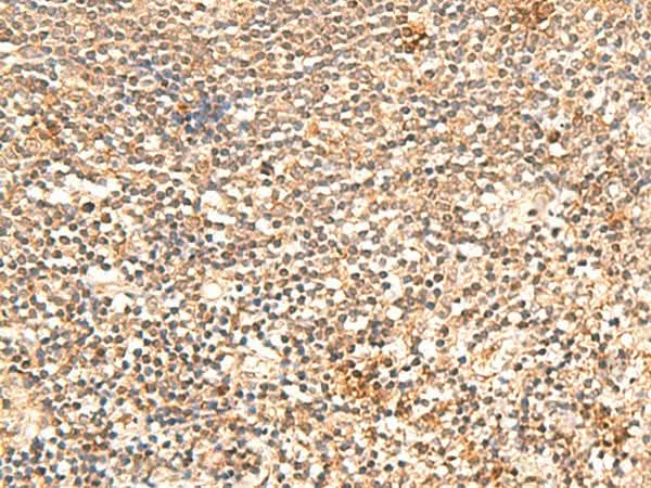 Immunohistochemistry of paraffin-embedded Human tonsil tissue using TRAPPC1 Polyclonal Antibody at dilution of 1:60(×200)