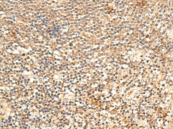 Immunohistochemistry of paraffin-embedded Human tonsil tissue using TRAPPC1 Polyclonal Antibody at dilution of 1:60(×200)