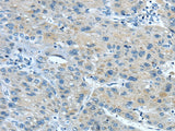 Anti-Human/Mouse TNIP1 Antibody - ABMIUM