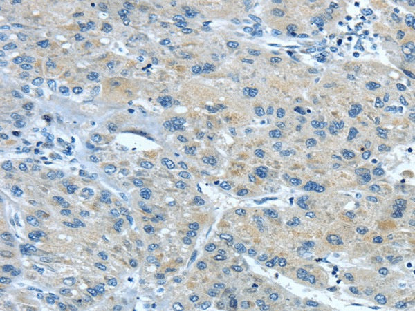 Anti-Human/Mouse TNIP1 Antibody - ABMIUM