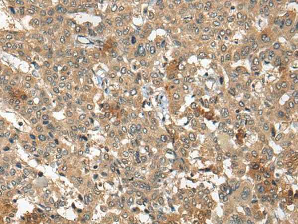 Anti-Human/Mouse/Rat ARCN1 Antibody