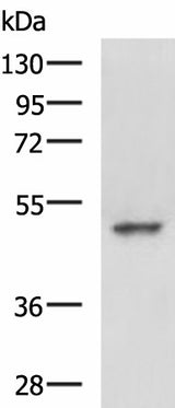 Western blot analysis of Hela cell lysate using MYCN Polyclonal Antibody at dilution of 1:800