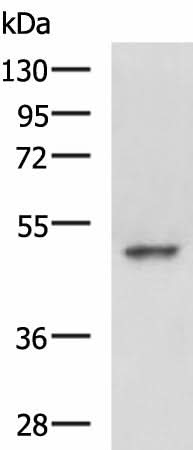 Western blot analysis of Hela cell lysate using MYCN Polyclonal Antibody at dilution of 1:800