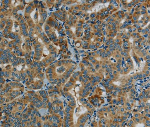 Anti-Human PPARGC1B Antibody - ABMIUM