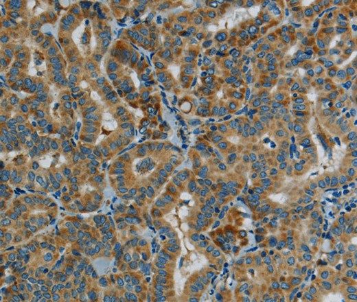 Anti-Human PPARGC1B Antibody - ABMIUM