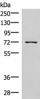 Western blot analysis of 293T cell lysate using EIF2AK1 Polyclonal Antibody at dilution of 1:350