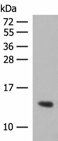Western blot analysis of Human plasma solution using HBG1:HBG2 Polyclonal Antibody at dilution of 1:350
