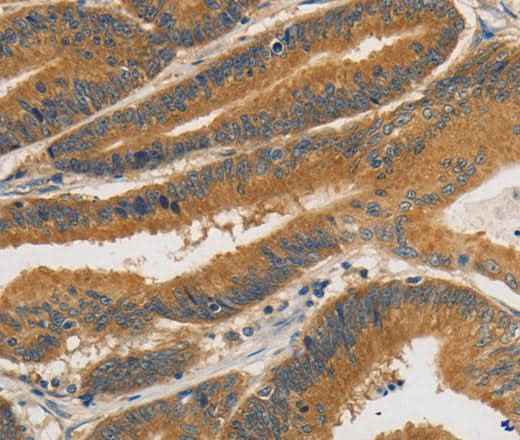 Anti-Human/Mouse/Rat PRKD1 Antibody