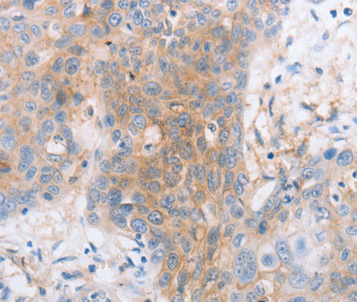 Anti-Human CD85d Antibody - ABMIUM
