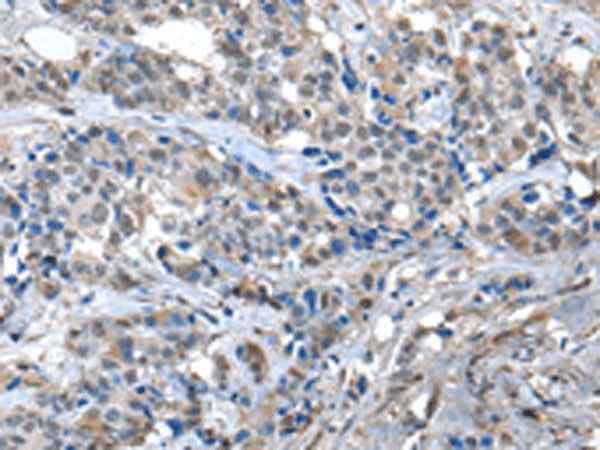 Anti-Human/Mouse ZFP2 Antibody