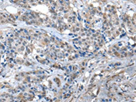 Anti-Human/Mouse ZFP2 Antibody