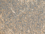 Immunohistochemistry of paraffin-embedded Human tonsil tissue using GPBP1 Polyclonal Antibody at dilution of 1:65(×200)