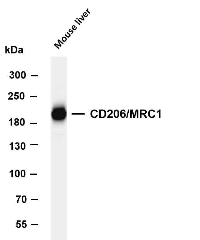 Anti-Human/Mouse/Rat CD206 Antibody [B1120]