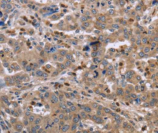Anti-Human/Mouse EDA Antibody