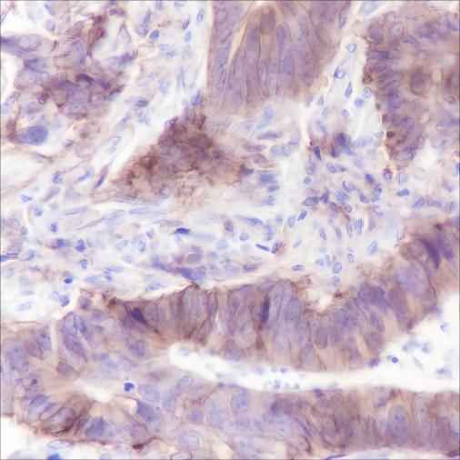Anti-Human hENT1 Antibody [A246]