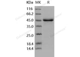 Recombinant Human SerpinE1/PAI-1 Protein (His Tag) - ABMIUM