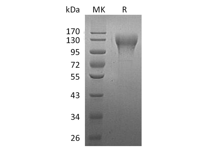 Recombinant Human CD96 Protein (His Tag) - ABMIUM