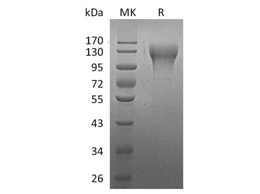 Recombinant Human CD96 Protein (His Tag) - ABMIUM