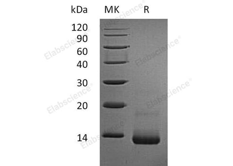 Recombinant Rat CCL5/RANTES Protein (His Tag) - ABMIUM